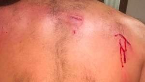 Parla il tifoso aggredito: «Napoletani liberi di uscire. Ecco il risultato»