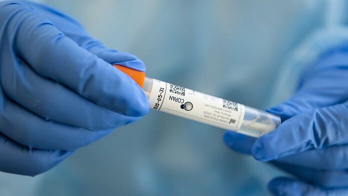 tampone-coronavirus2 tampone coronavirus